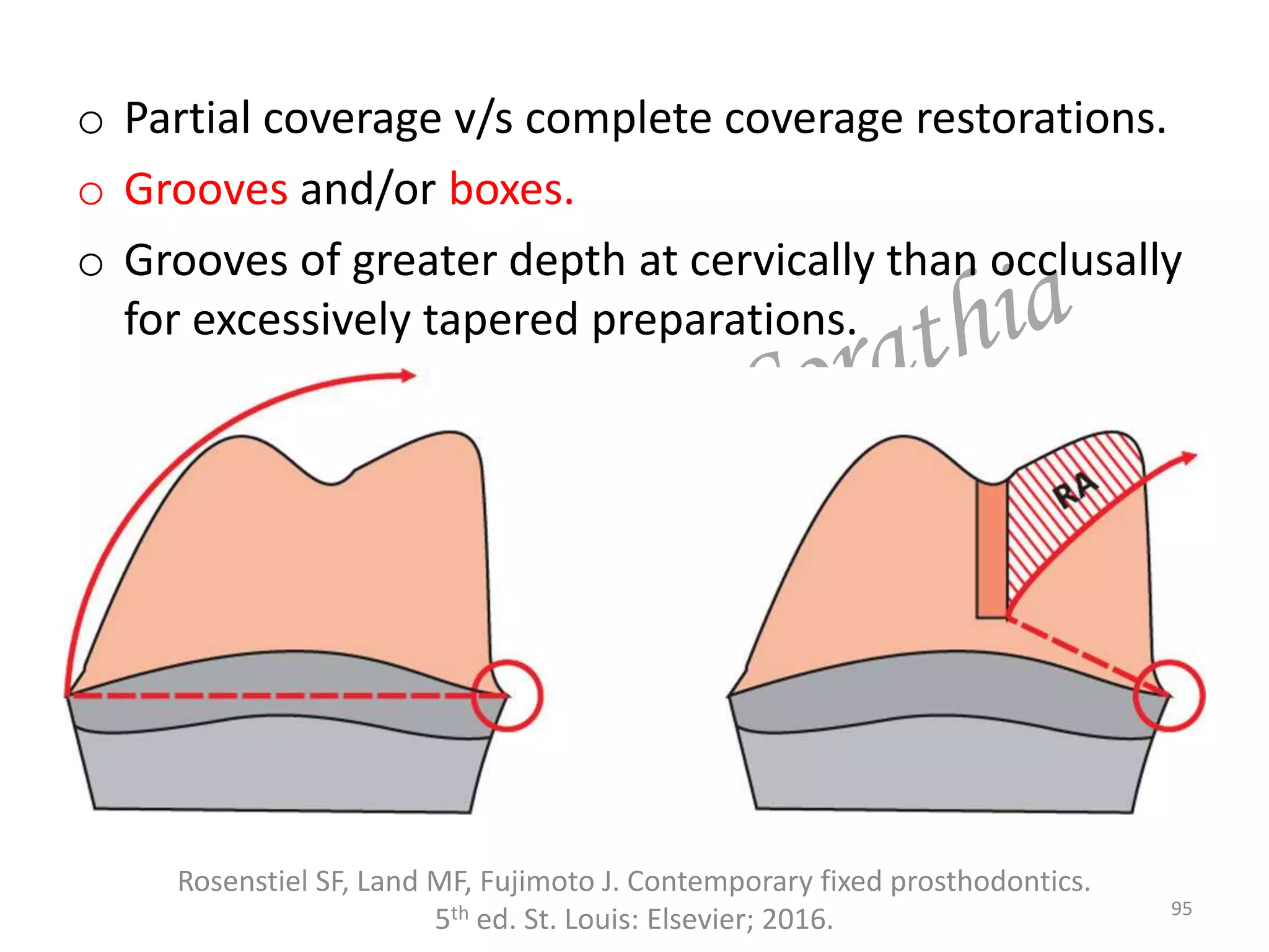Rosenstiel SF, Land MF, Fujimoto J. Contemporary fixed prosthodontics.
5th ed. St. Louis: Elsevier; 2016. 95
o Partial coverage v/s complete coverage restorations.
o Grooves and/or boxes.
o Grooves of greater depth at cervically than occlusally
for excessively tapered preparations.
 