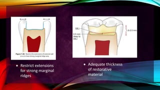 Sufficient Ridges Principles of tooth preparation | PPTX