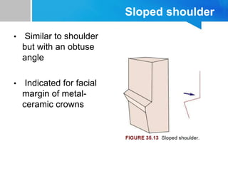 Normal Crown Slopes principles of tooth preparation - ann george final.pptx