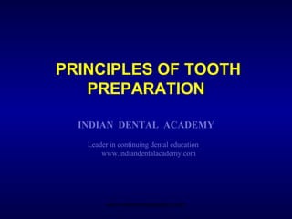 PRINCIPLES OF TOOTH
PREPARATION
INDIAN DENTAL ACADEMY
Leader in continuing dental education
www.indiandentalacademy.com
www.indiandentalacademy.com
 