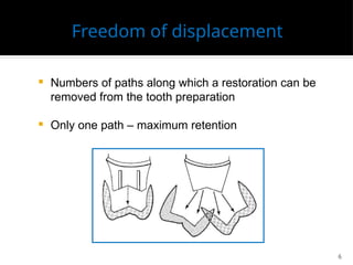 Principles of tooth preparation. biologic | PPTX