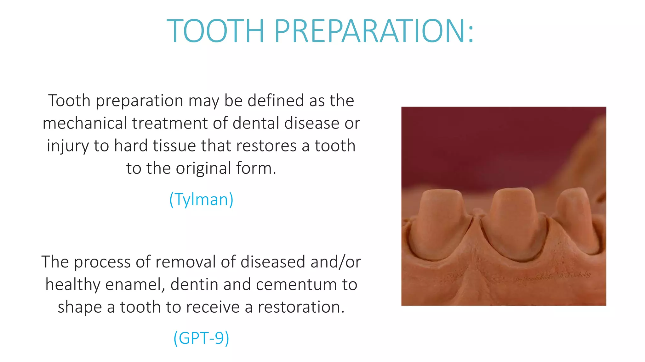 Principles of tooth preparation | PPTX
