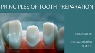 PRINCIPLES OF TOOTH PREPARATION
PRESENTED BY:
Dr. SONALI HARJANI
III M.D.S.
 