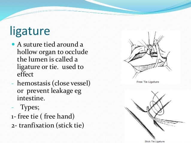 Principles of use and abuse of suture 1