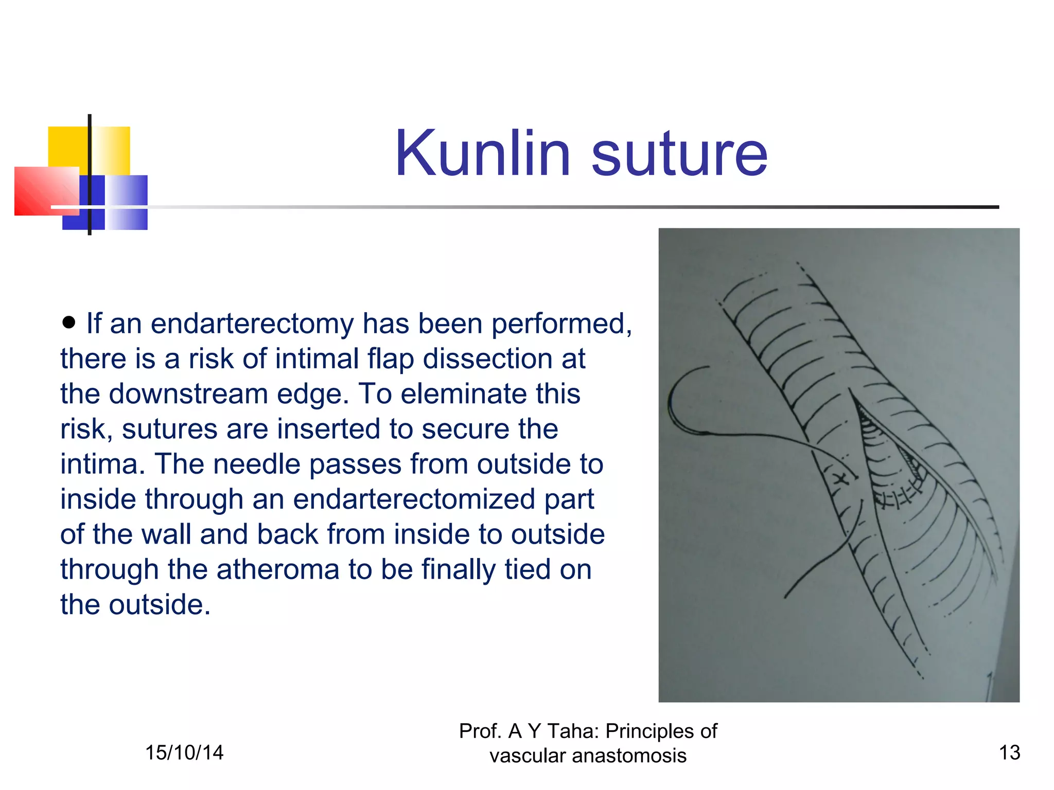 Principles of vascular anastomosis | PPT