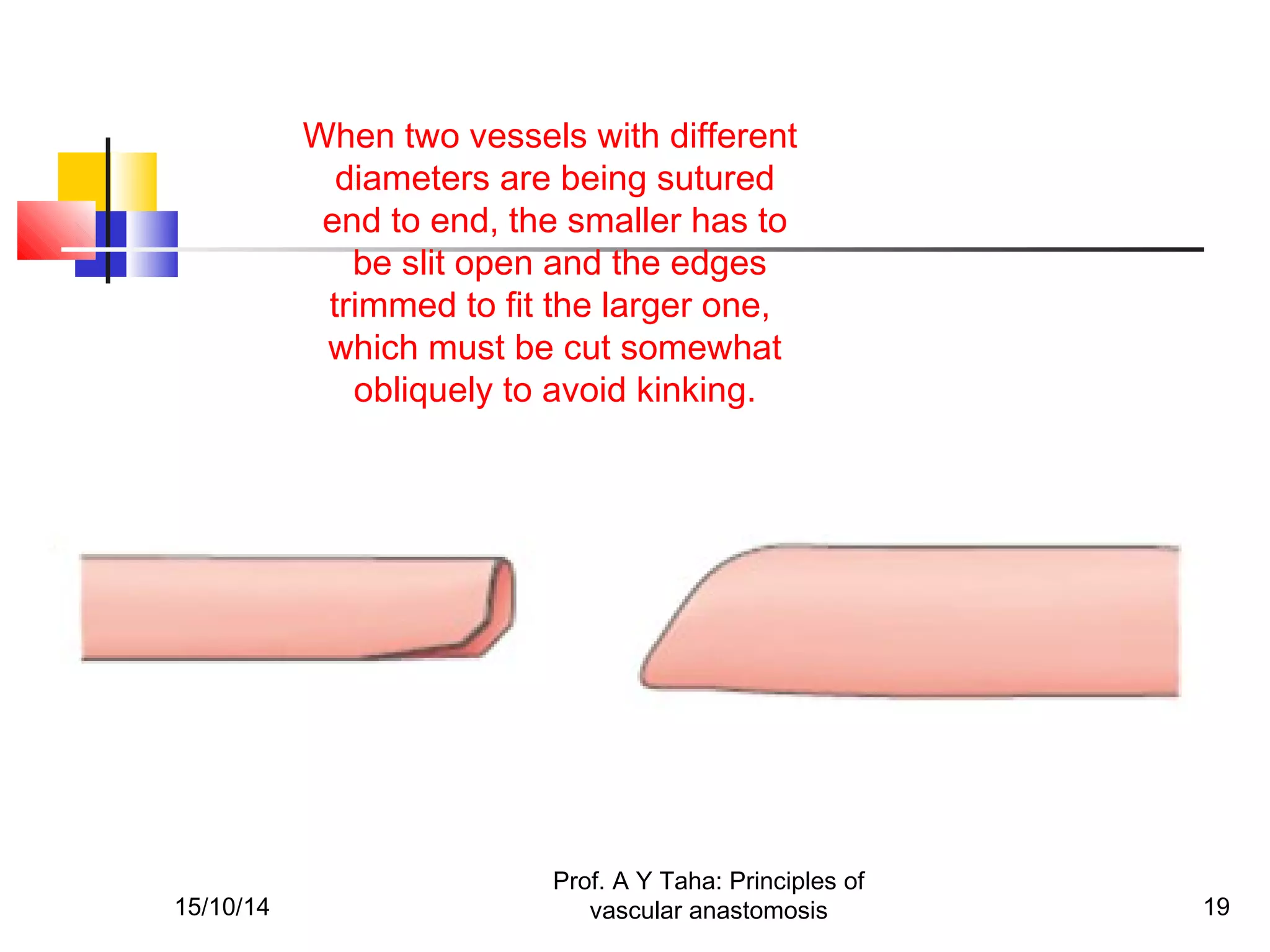 Principles of vascular anastomosis | PPT