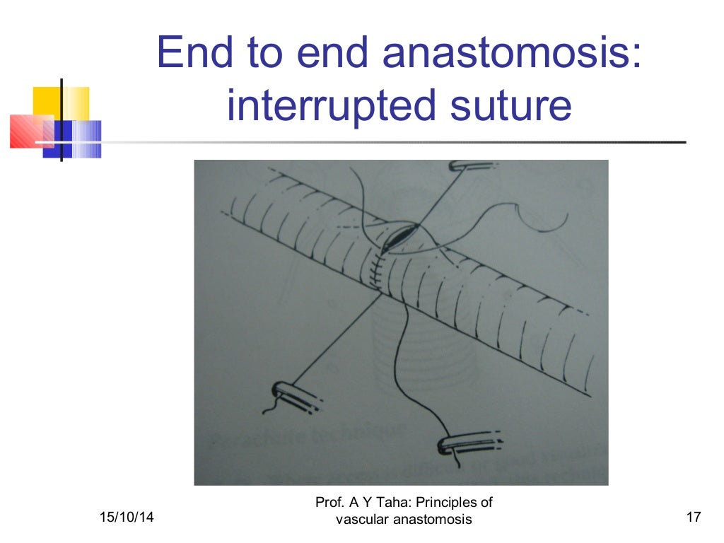 Principles of vascular anastomosis