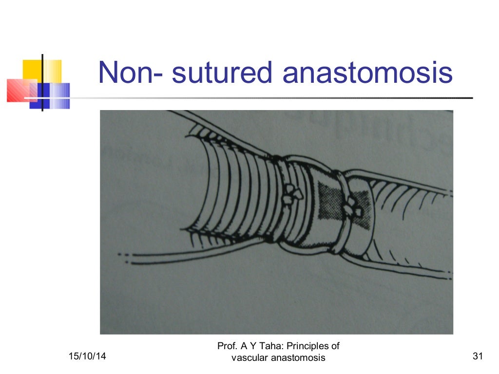 Principles of vascular anastomosis