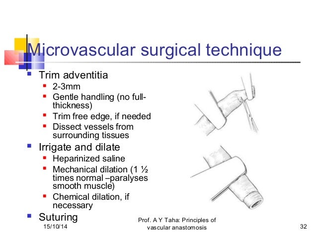 vascular anastomosis