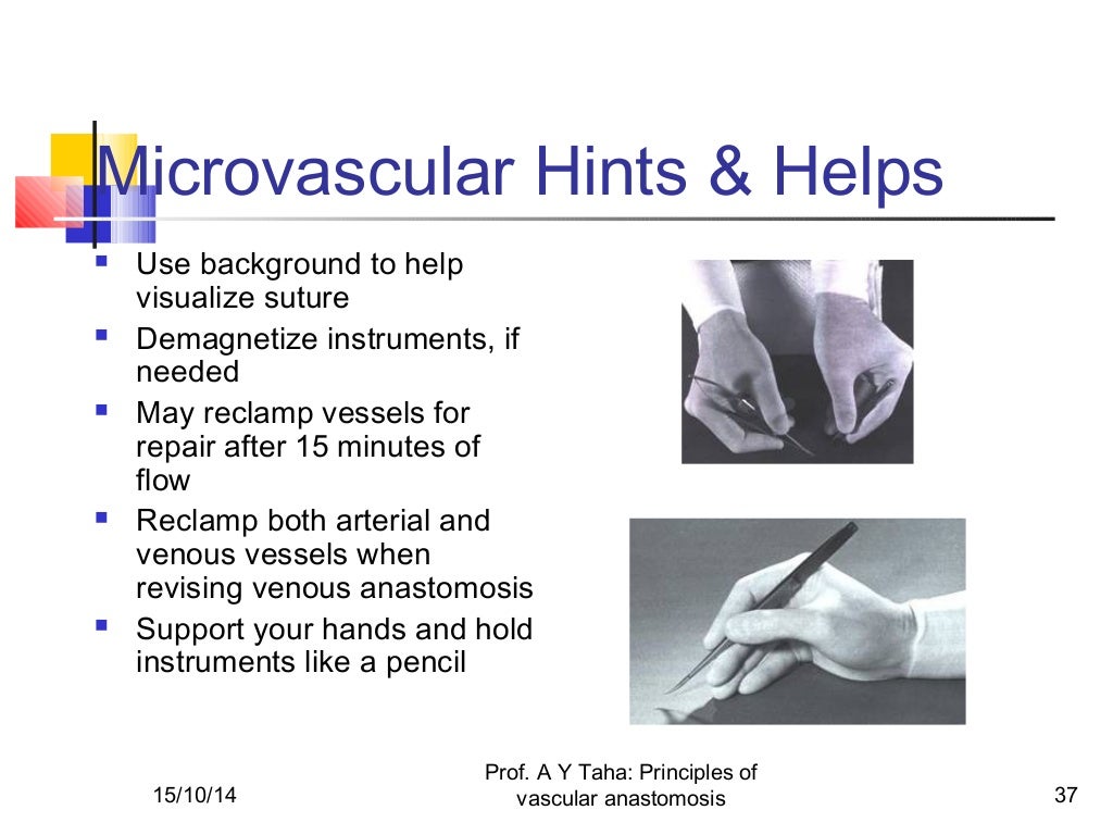 Principles of vascular anastomosis