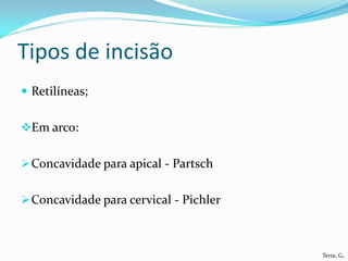 Tipos de incisão
 Retilíneas;


Em arco:


 Concavidade para apical - Partsch


 Concavidade para cervical - Pichler



                                        Terra, G.
 
