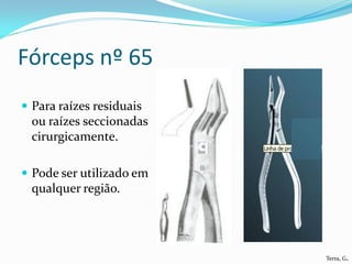 Fórceps nº 65
 Para raízes residuais
  ou raízes seccionadas
  cirurgicamente.

 Pode ser utilizado em
  qualquer região.




                          Terra, G.
 