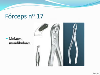 Fórceps nº 17


 Molares
 mandibulares




                Terra, G.
 