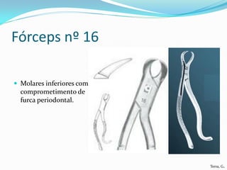 Fórceps nº 16

 Molares inferiores com
  comprometimento de
  furca periodontal.




                           Terra, G.
 