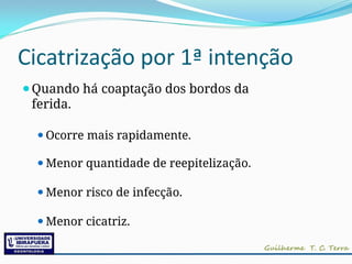 Cicatrização por 1ª intenção
⚫Quando há coaptação dos bordos da
ferida.
⚫Ocorre mais rapidamente.
⚫Menor quantidade de reepitelização.
⚫Menor risco de infecção.
⚫Menor cicatriz.
 