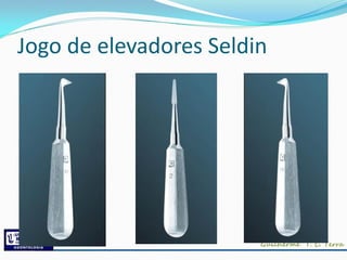 Jogo de elevadores Seldin
 