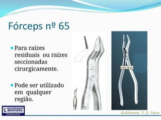 Fórceps nº 65
⚫Para raízes
residuais ou raízes
seccionadas
cirurgicamente.
⚫Pode ser utilizado
em qualquer
região.
 