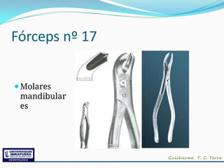 Fórceps nº 17
⚫Molares
mandibular
es
 