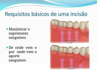 Requisitos básicos de uma incisão
⚫Maximizar o
suprimento
sanguíneo
⚫De onde vem e
por onde vem o
aporte
sanguíneo
 