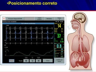 •Posicionamento correto
 