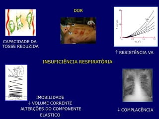 INSUFICIÊNCIA RESPIRATÓRIA
CAPACIDADE DA
TOSSE REDUZIDA
 RESISTÊNCIA VA
 COMPLACÊNCIA
DOR
IMOBILIDADE
 VOLUME CORRENTE
ALTERÇÕES DO COMPONENTE
ELASTICO
 