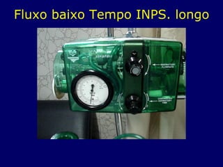Fluxo baixo Tempo INPS. longo
 