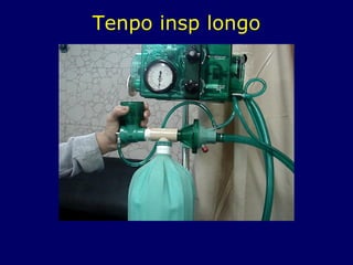Tenpo insp longo
 