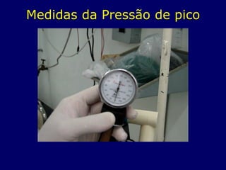Medidas da Pressão de pico
 