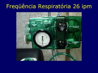 Freqüência Respiratória 26 ipm
 
