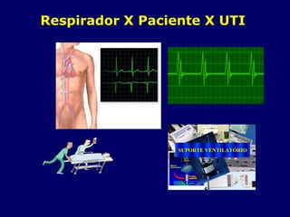 Respirador X Paciente X UTI
SUPORTE VENTILATSUPORTE VENTILATÓÓRIORIO
 
