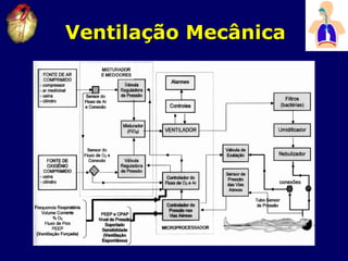 Ventilação Mecânica
 