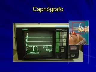 Capnógrafo
 