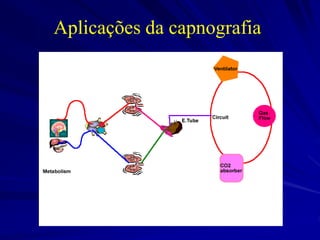 Aplicações da capnografia
 