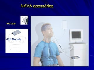 •97
•Edi Catheter
NAVA acessórios
•Edi Cable
•PC Card
•Edi Module
 