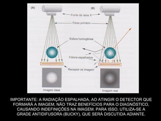 IMPORTANTE: A RADIAÇÃO ESPALHADA, AO ATINGIR O DETECTOR QUE
 FORMARÁ A IMAGEM, NÃO TRAZ BENEFÍCIOS PARA O DIAGNÓSTICO,
   CAUSANDO INDEFINIÇÕES NA IMAGEM. PARA ISSO, UTILIZA-SE A
   GRADE ANTIDIFUSORA (BUCKY), QUE SERÁ DISCUTIDA ADIANTE.
 