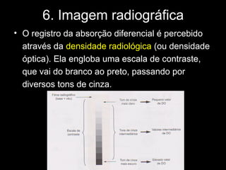 6. Imagem radiográfica
• O registro da absorção diferencial é percebido
  através da densidade radiológica (ou densidade
  óptica). Ela engloba uma escala de contraste,
  que vai do branco ao preto, passando por
  diversos tons de cinza.
 