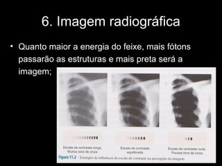 6. Imagem radiográfica
• Quanto maior a energia do feixe, mais fótons
  passarão as estruturas e mais preta será a
  imagem;
 