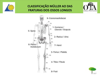 CLASSIFICAÇÃO MÜLLER AO DAS
FRATURAS DOS OSSOS LONGOS
 