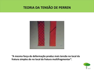TEORIA DA TENSÃO DE PERREN
“A mesma força de deformação produz mais tensão no local da
fratura simples do no local da fratura multifragmentar”.
 