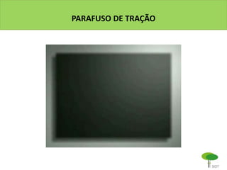 PARAFUSO DE TRAÇÃO
 