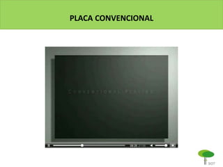 PLACA CONVENCIONAL
 