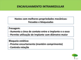 ENCAVILHAMENTO INTRAMEDULAR
Hastes com melhores propriedades mecânicas:
fresadas e bloqueadas
Fresagem:
- Aumenta a área de contato entre o implante e o osso
- Permite utilização de implante com diâmetro maior
Bloqueio estático:
- Previne encurtamento (mantém comprimento)
- Controla rotação
 