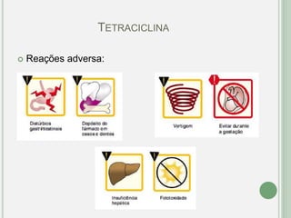 TETRACICLINA
 Reações adversa:
 