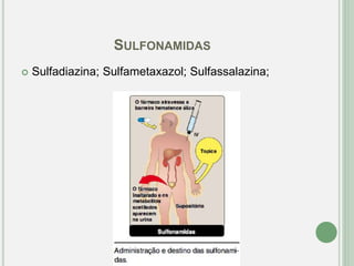 SULFONAMIDAS
 Sulfadiazina; Sulfametaxazol; Sulfassalazina;
 