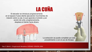 LA CUÑA
El elevador se introduce progresivamente
en el espacio hueso-diente ejecutando movimientos de
rotación sobre su eje, lo que agranda el alvéolo y por
acción de cuña, progresivamente,
desplaza el diente hacia afuera
La extracción se puede completar por este
procedimiento o con el uso de fórceps
Gay C, Berini L. Cirugía bucal. Barcelona: OCÉANO / ERGÓN; 2004
 