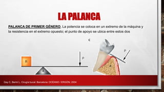 PALANCA DE PRIMER GÉNERO, La potencia se coloca en un extremo de la máquina y
la resistencia en el extremo opuesto; el punto de apoyo se ubica entre estos dos
LA PALANCA
Gay C, Berini L. Cirugía bucal. Barcelona: OCÉANO / ERGÓN; 2004
 