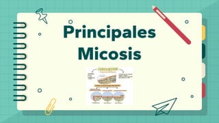 Principales
Micosis
 