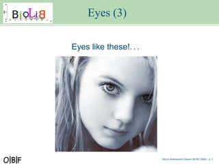 Eyes (3)

Eyes like these!. . .




                        BioLib Development Report (BOSC 2009) – p.
 