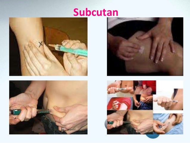 Prinsip dan tehnik pemberian obat subcutan dan intracutan Prinsip dan tehnik pemberian obat subcutan dan intracutan