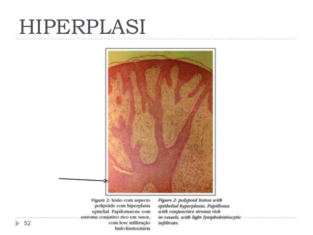 perubahan pada kulit yang bersifat progresif (modul kulit